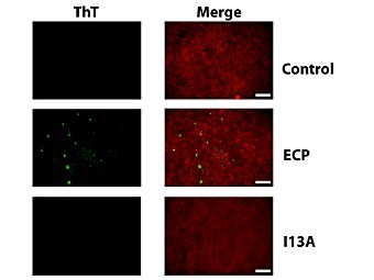    ECP ( )      ().  Treent at al., PLoS Pathogen., 2012